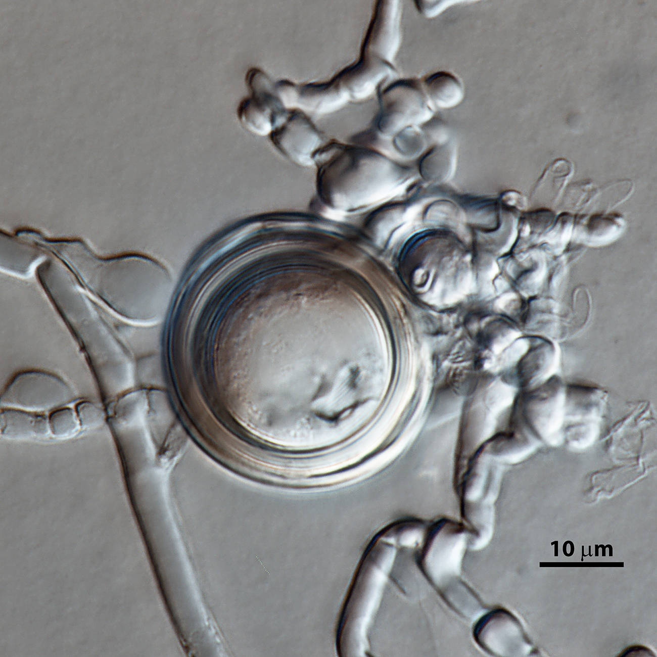   Phytophthora pseudosyringae nbsp;(ex-type CPHST BL 51G) sexual phase: slightly aplerotic oosporenbsp;with paragynous antheridium and knotted hyphae; photonbsp;by Vickie Brewster, USDA-APHIS-PPQ. 
